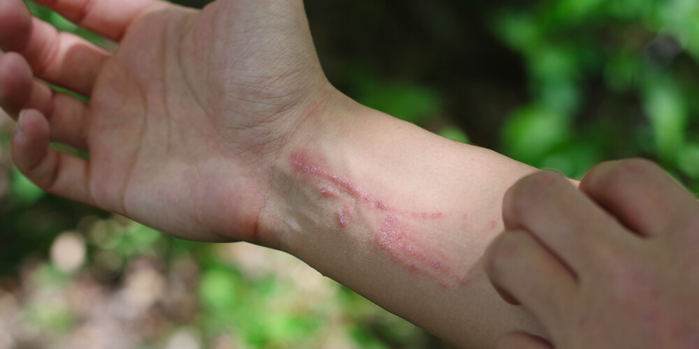 wilson-how-to-identify-and-remove-poison-ivy-04
