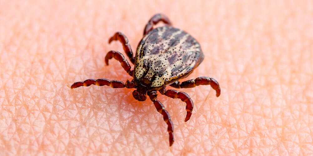wilson-how-to-identify-and-remove-a-tick-01